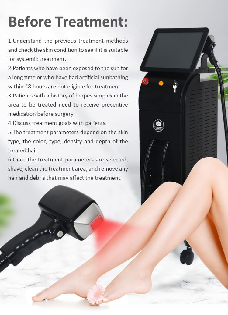 laser treatment for facial hair removal