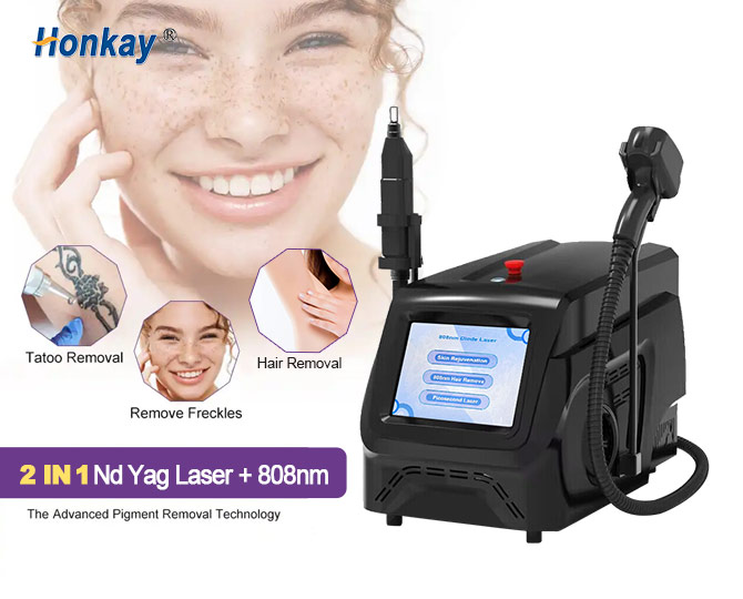 nd yag laser tattoo removal machine price