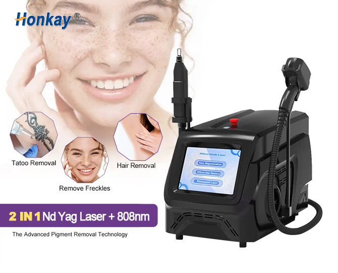 nd yag tattoo removal machine