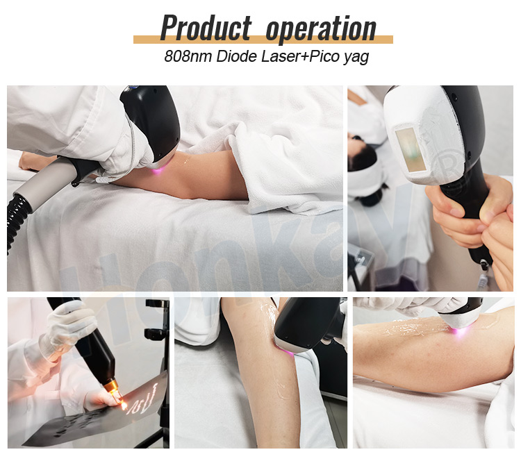 808nm Diode Laser pico yag hair removal Machine