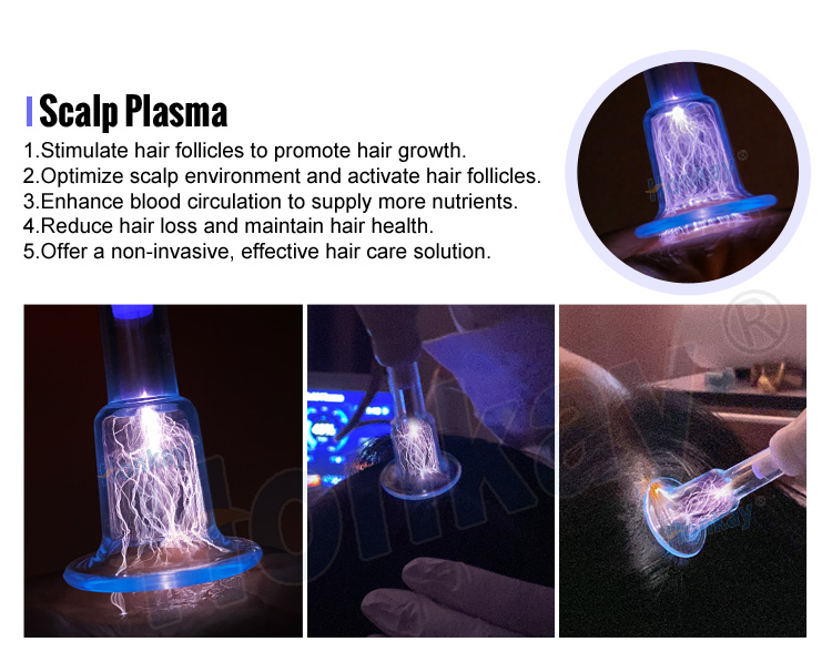plasma pen wrinkle removal