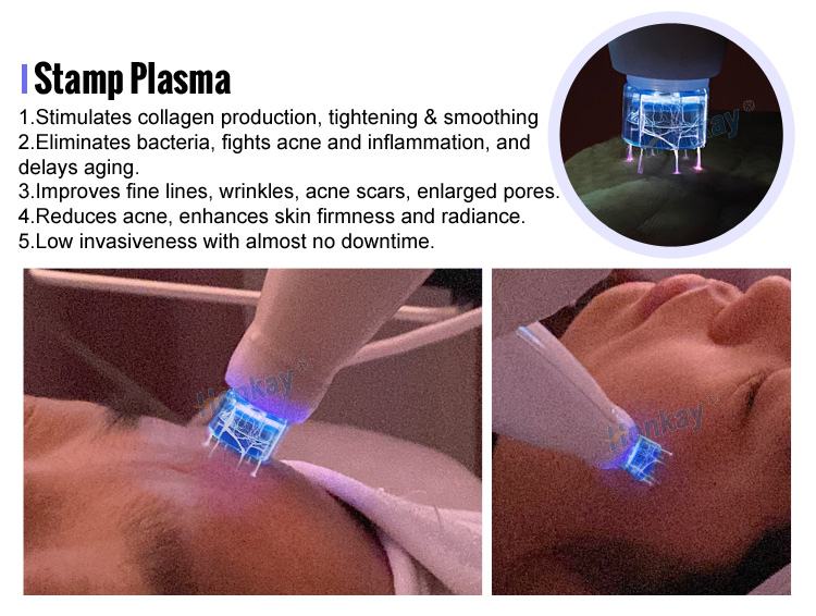 plasma pen wrinkle removal