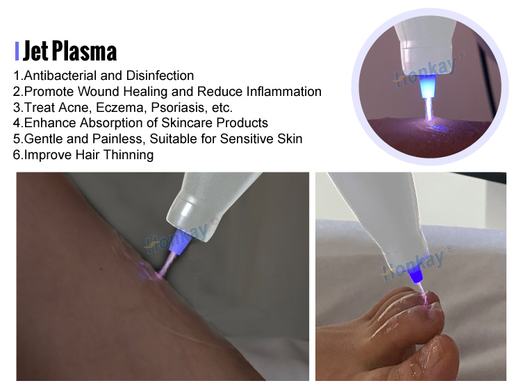 plasma pen wrinkle removal