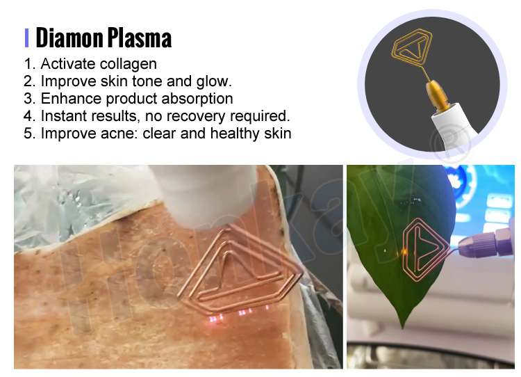 plasma pen wrinkle removal