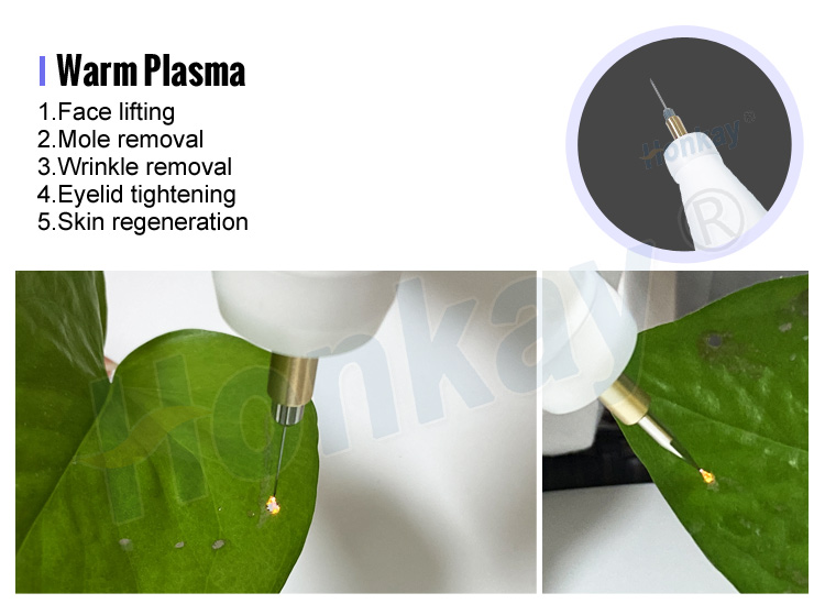 plasma pen wrinkle removal
