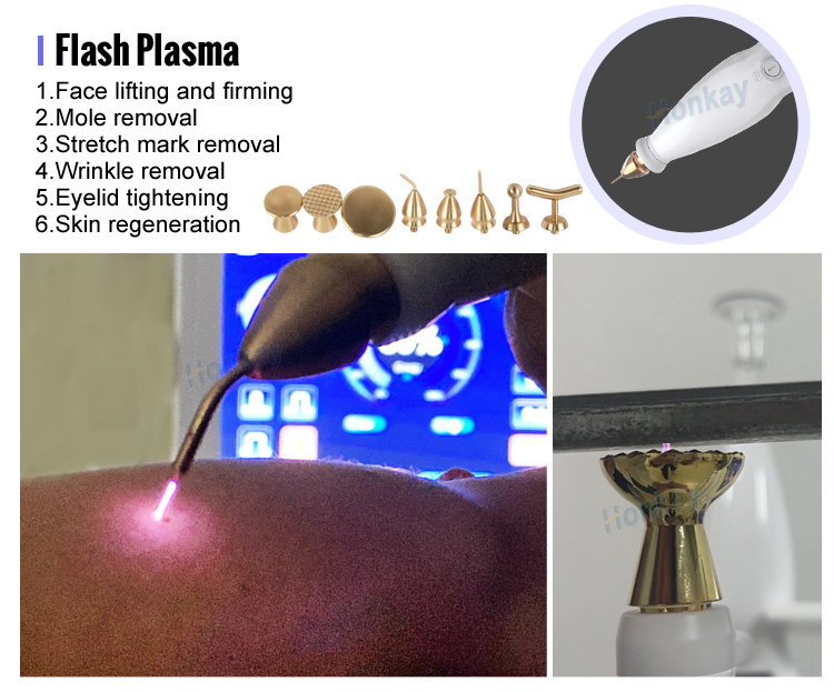plasma pen wrinkle removal