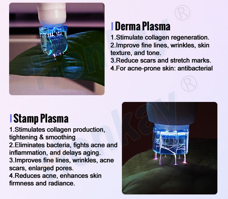 Cold plasma pen for calming stage after intensive treatments