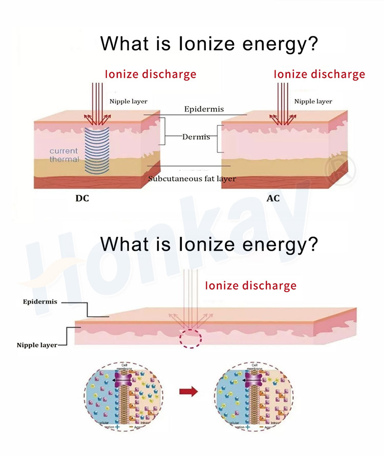 plasma pen ozone therapy