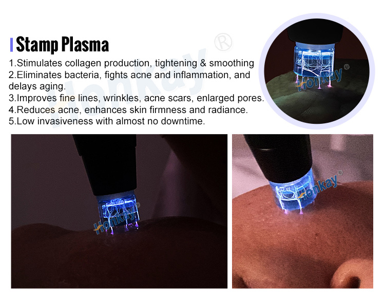 cold and warm plasma device