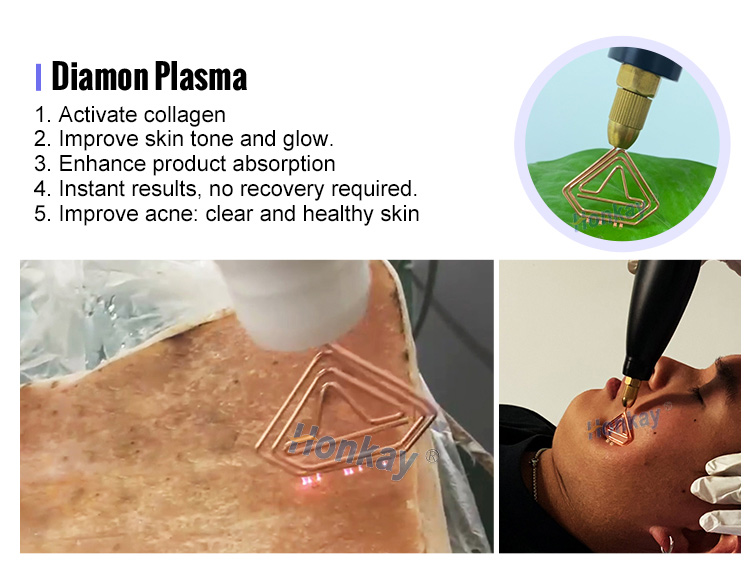 cold and warm plasma device