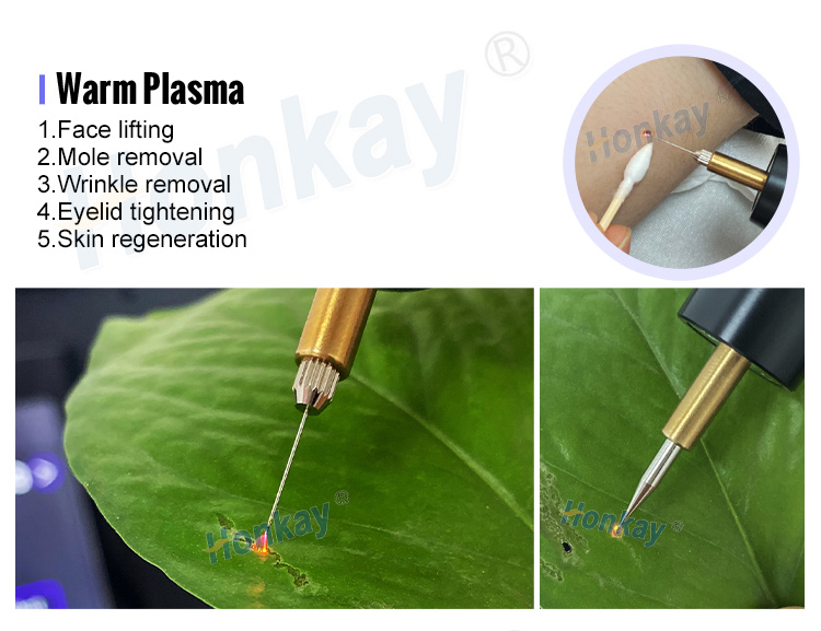 cold and warm plasma device