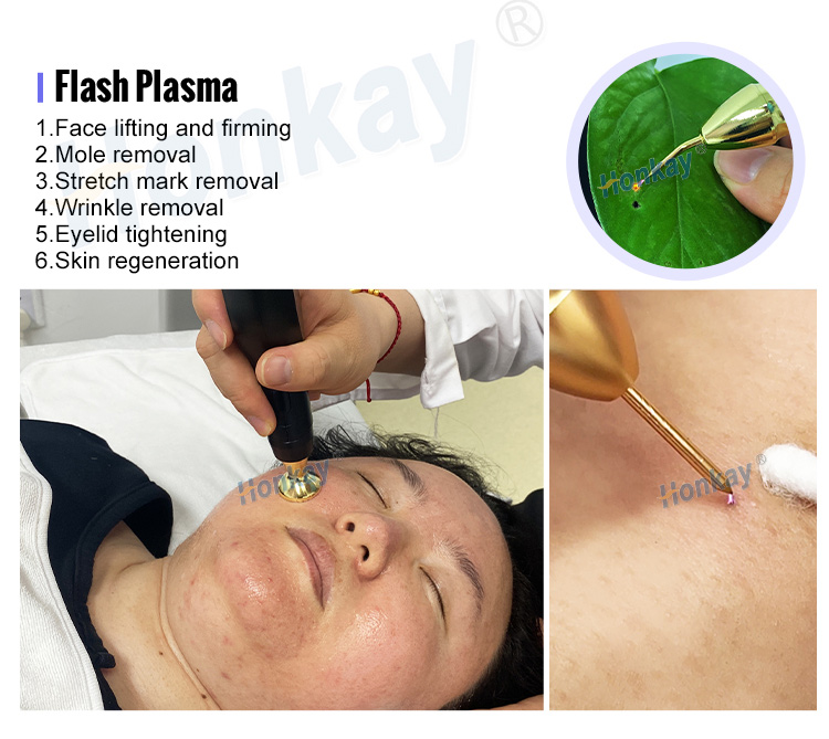 cold and warm plasma device