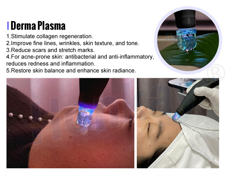 cold plasma facial device