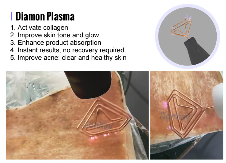 cold plasma facial device