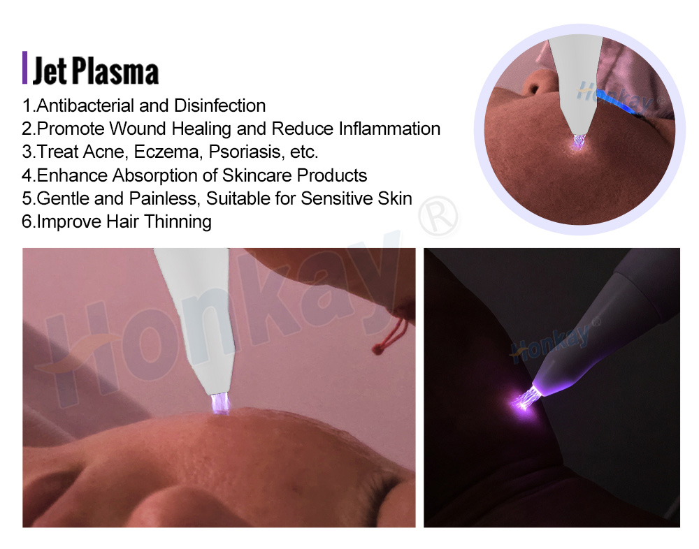 Jet plasma handpiece with airbrush-style electrode