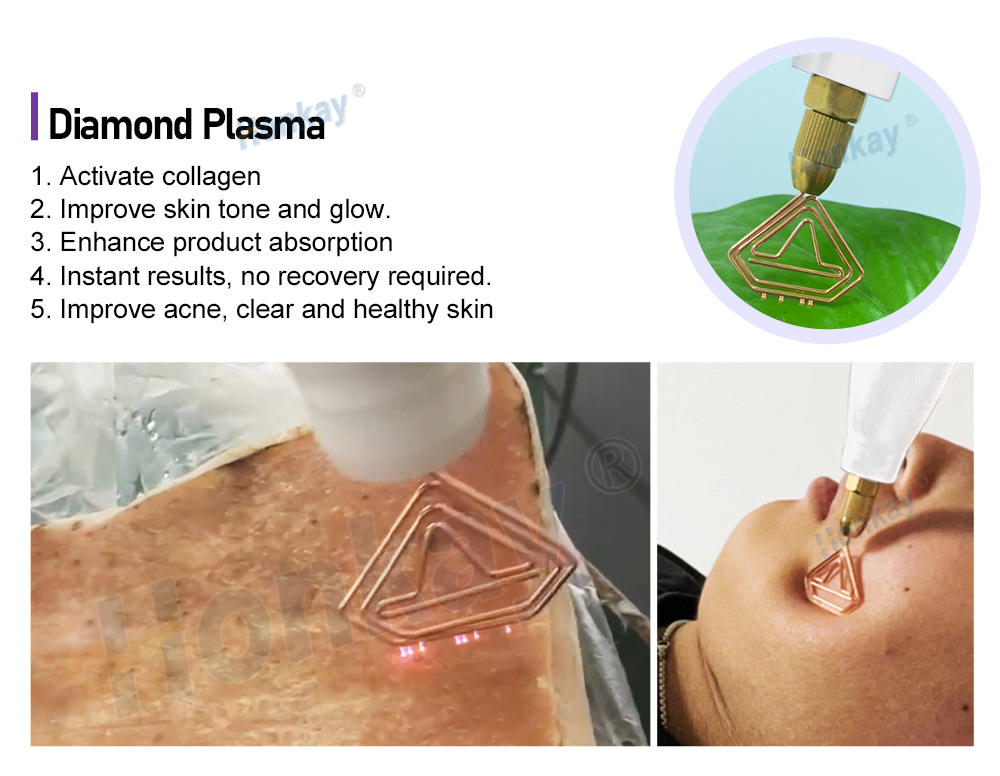 Gold diamond plasma triangular working head in use
