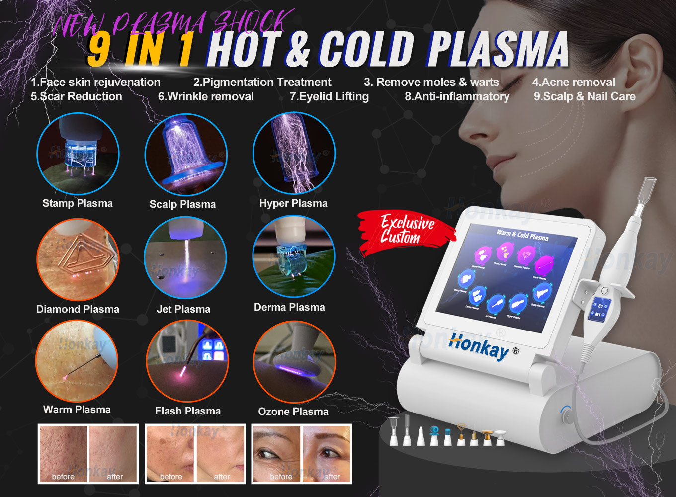 cold and warm plasma device