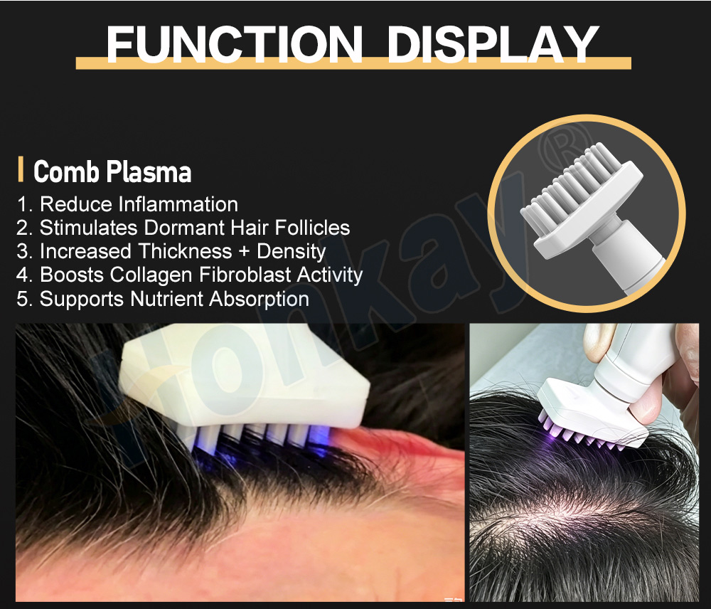 comb plasma tip treating the hairline and the crown parting line