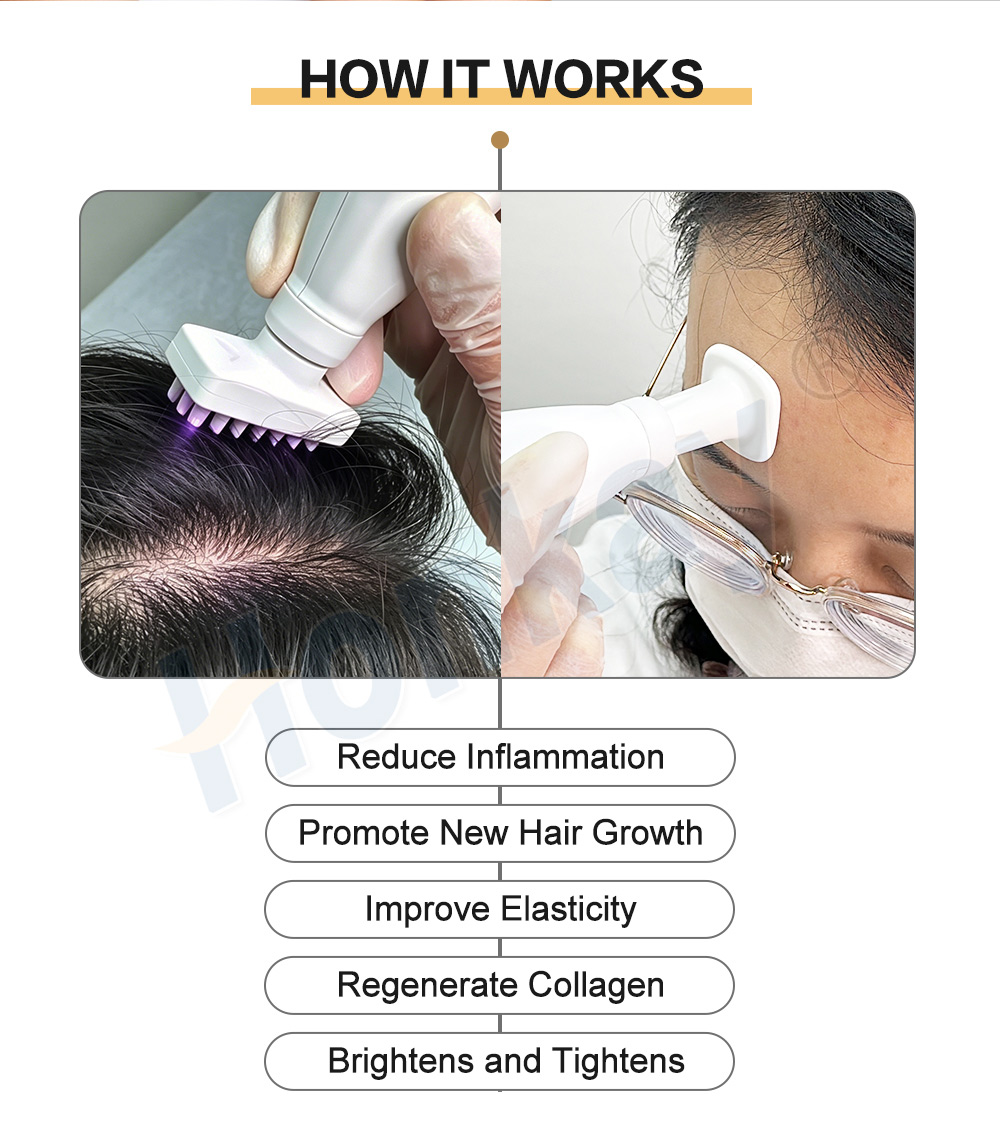 five expected effects of the ozone comb plasma treatment
