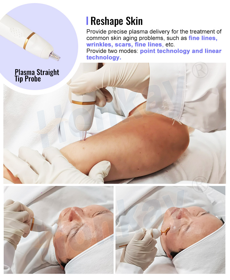 fibroblast plasma skin tightening machine 4