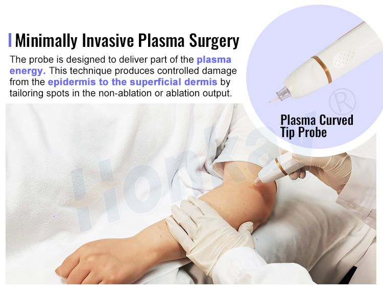 fibroblast plasma skin tightening machine 5